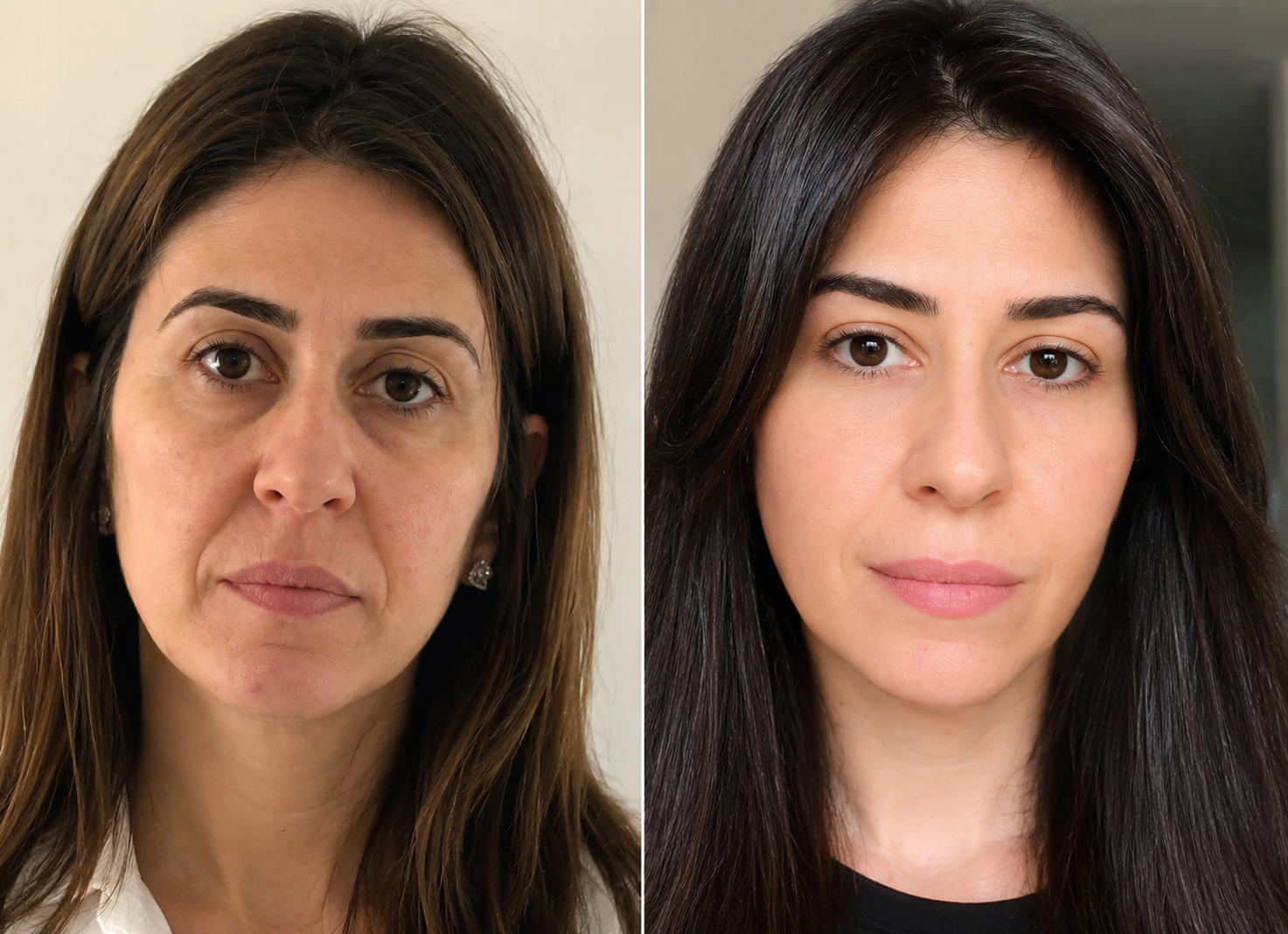 Antes y después 2