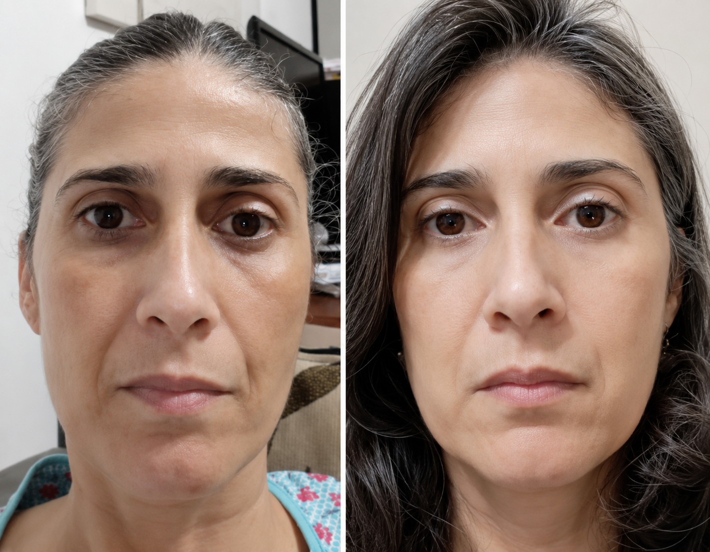 Antes y después 3